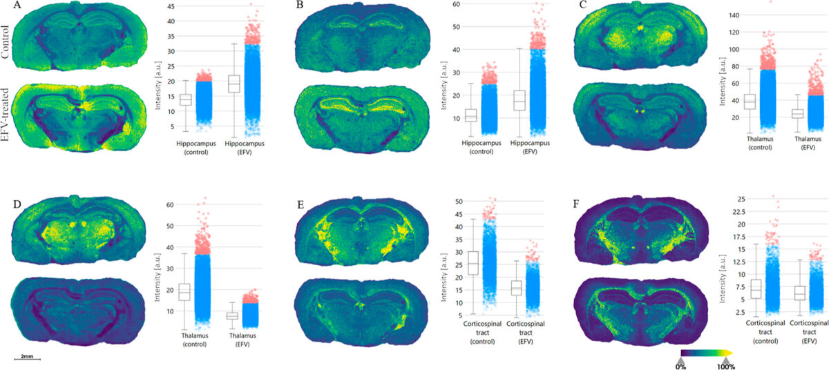 New study increases understanding of HIV drug’s negative effects on the brain