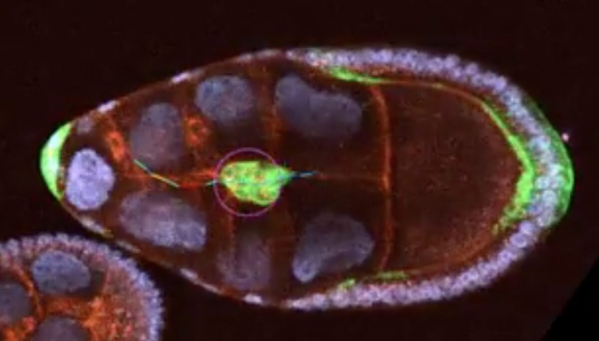 Interdisciplinary UMBC team deepens understanding of cell migration, important for potential medical advances